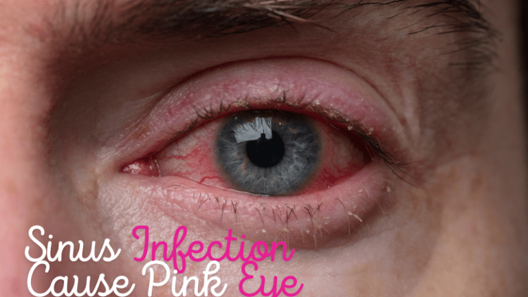 Can a Sinus Infection Cause Pink Eye? Symptoms, Causes, and Treatment Explained