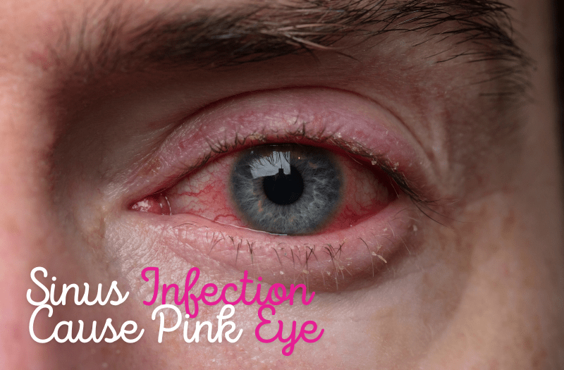 Can a Sinus Infection Cause Pink Eye